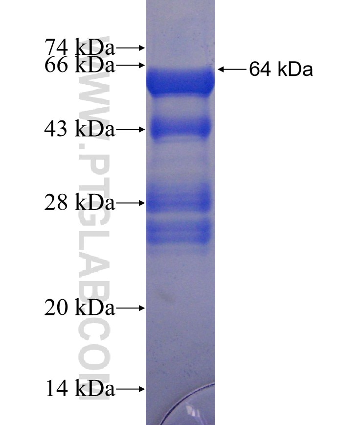 RAB11FIP3 fusion protein Ag22937 SDS-PAGE