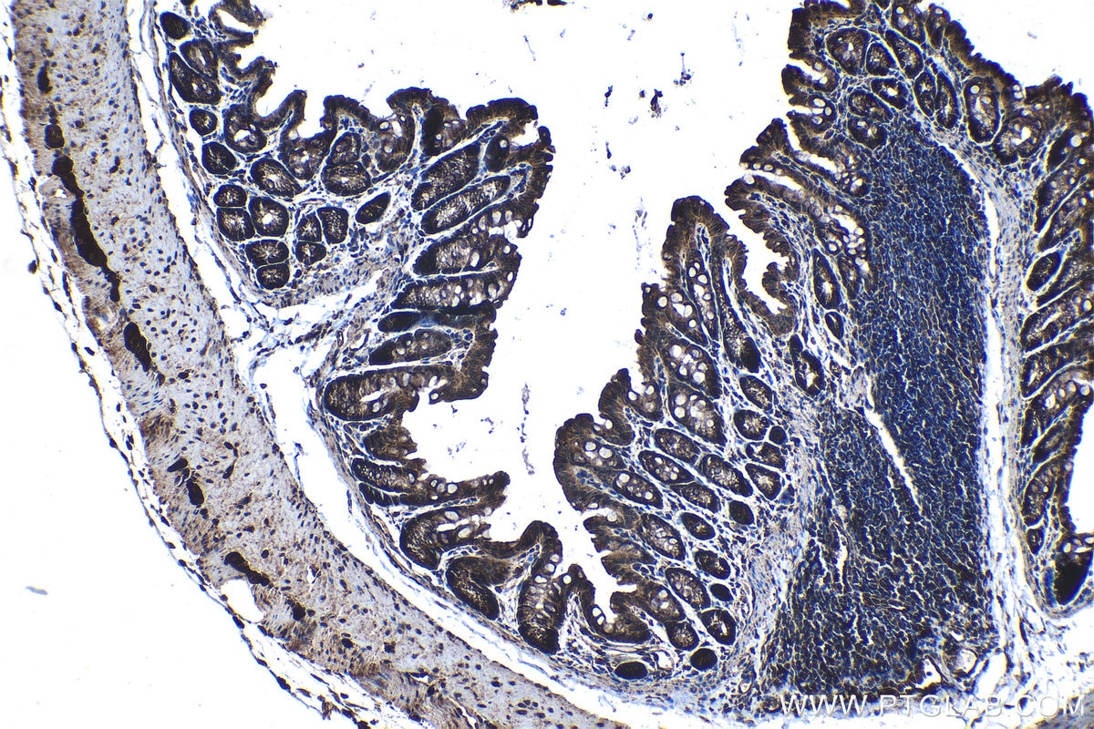 Immunohistochemistry (IHC) staining of mouse colon tissue using RAB11FIP5 Polyclonal antibody (14594-1-AP)
