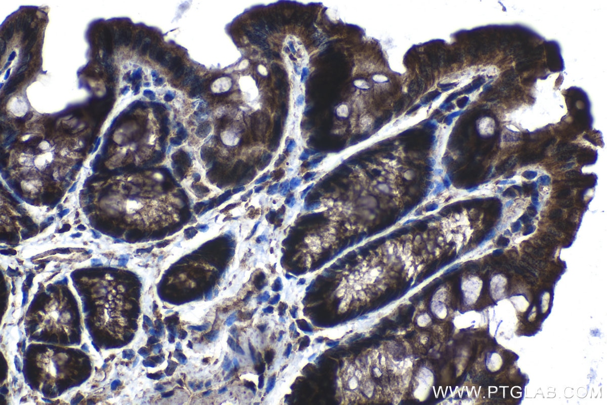 Immunohistochemistry (IHC) staining of mouse colon tissue using RAB11FIP5 Polyclonal antibody (14594-1-AP)