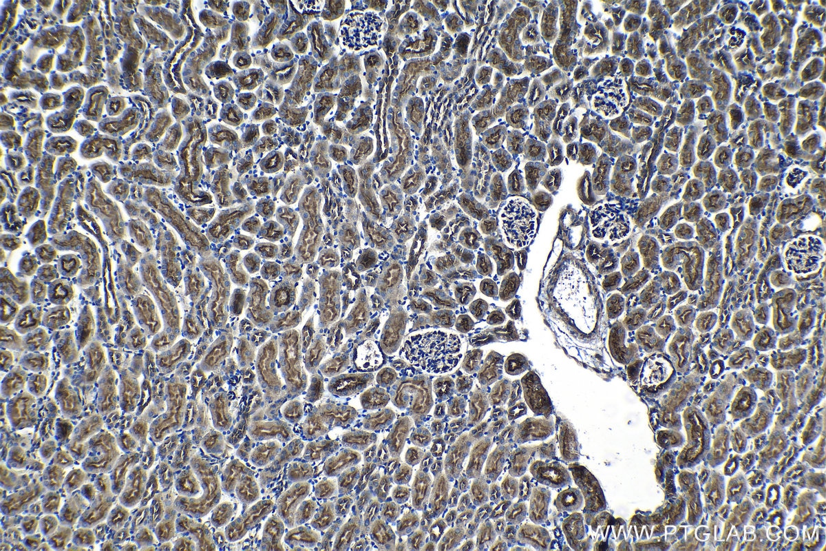 Immunohistochemistry (IHC) staining of mouse kidney tissue using RAB11FIP5 Polyclonal antibody (14594-1-AP)