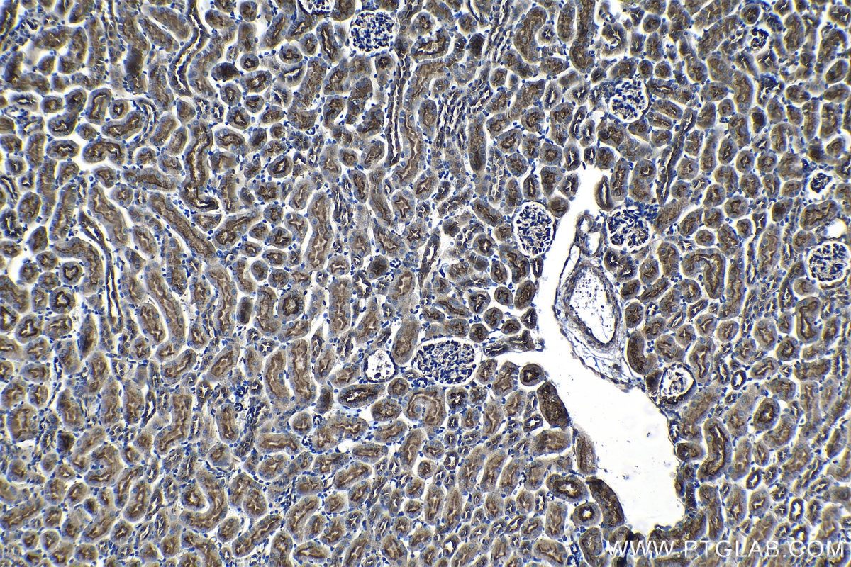 IHC staining of mouse kidney using 14594-1-AP