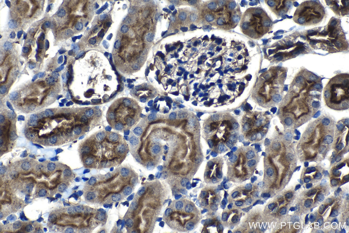 Immunohistochemistry (IHC) staining of mouse kidney tissue using RAB11FIP5 Polyclonal antibody (14594-1-AP)