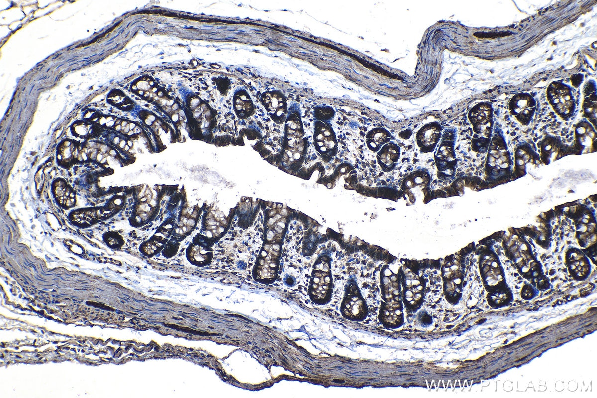 IHC staining of rat colon using 14594-1-AP