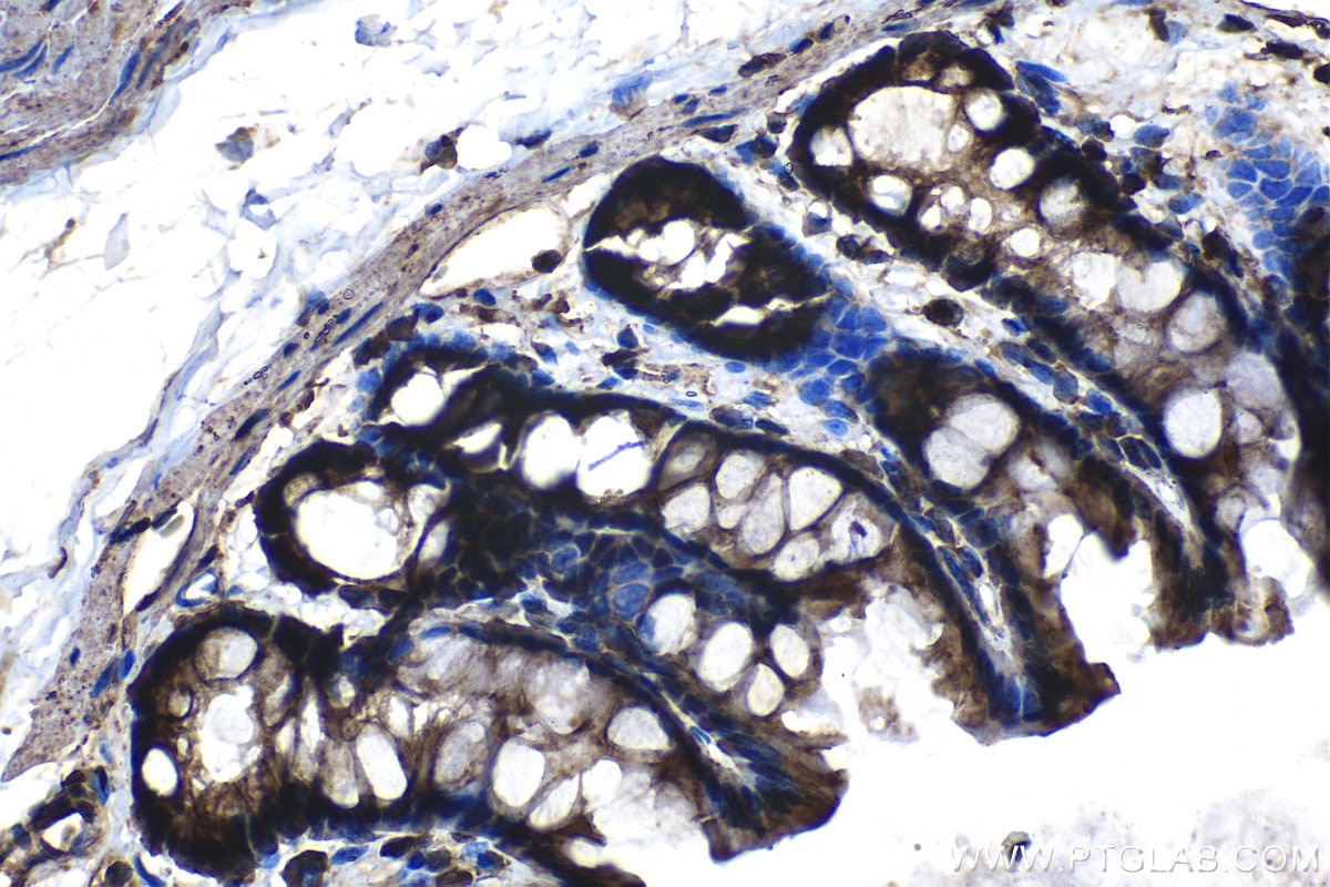 IHC staining of rat colon using 14594-1-AP