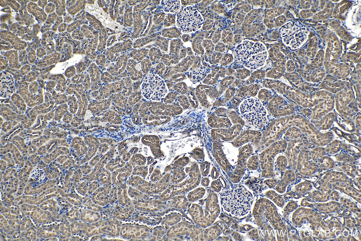 IHC staining of rat kidney using 14594-1-AP