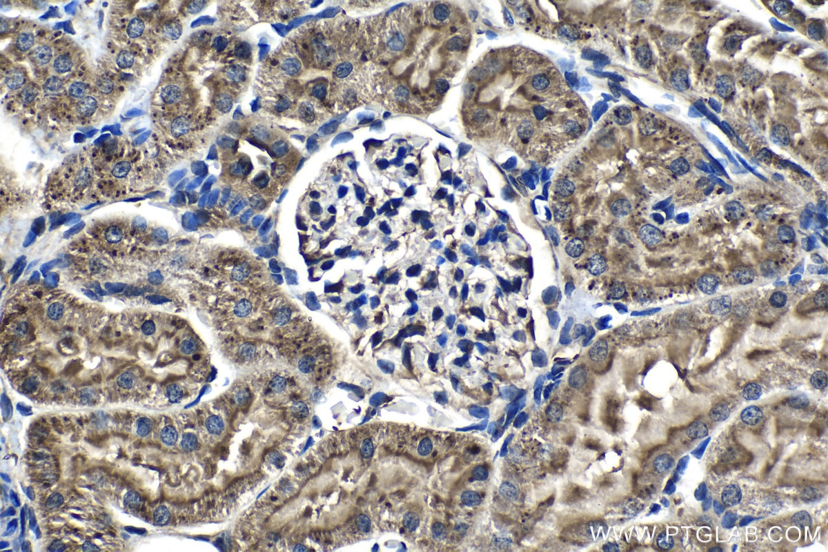 Immunohistochemistry (IHC) staining of rat kidney tissue using RAB11FIP5 Polyclonal antibody (14594-1-AP)