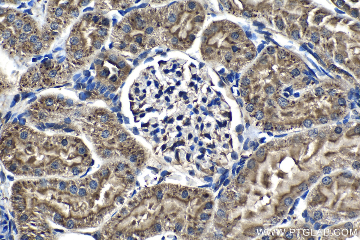 IHC staining of rat kidney using 14594-1-AP