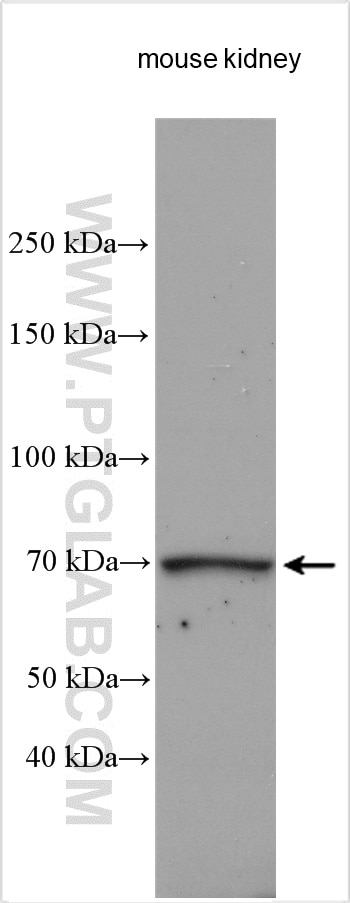Western Blot (WB) analysis of mouse kidney tissue using RAB11FIP5 Polyclonal antibody (14594-1-AP)