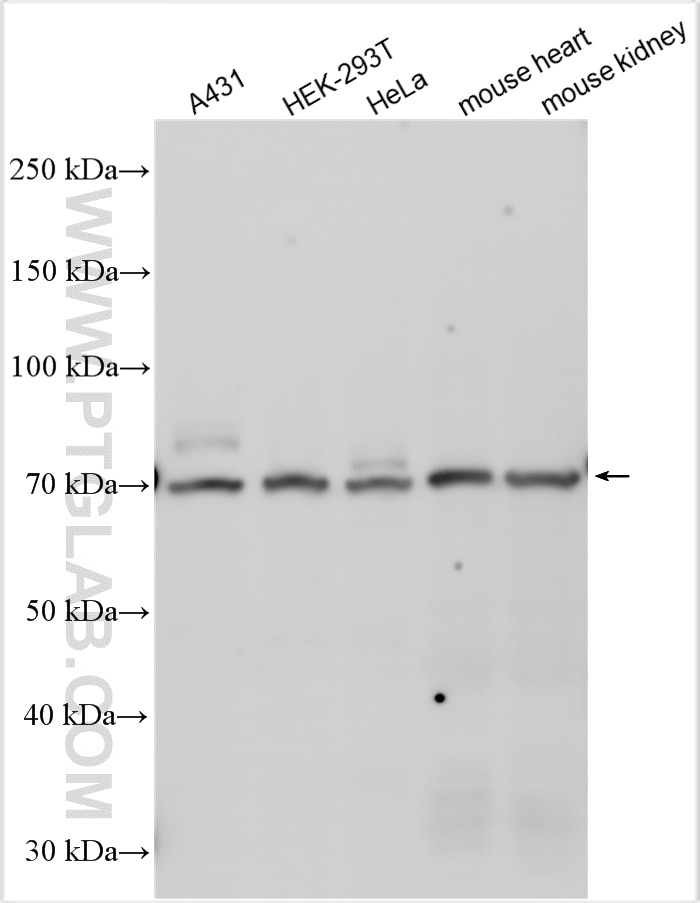 Western Blot (WB) analysis of various lysates using RAB11FIP5 Polyclonal antibody (14594-1-AP)