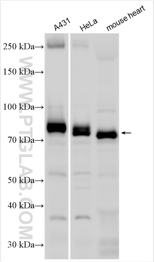 Western Blot (WB) analysis of various lysates using RAB11FIP5 Polyclonal antibody (14594-1-AP)
