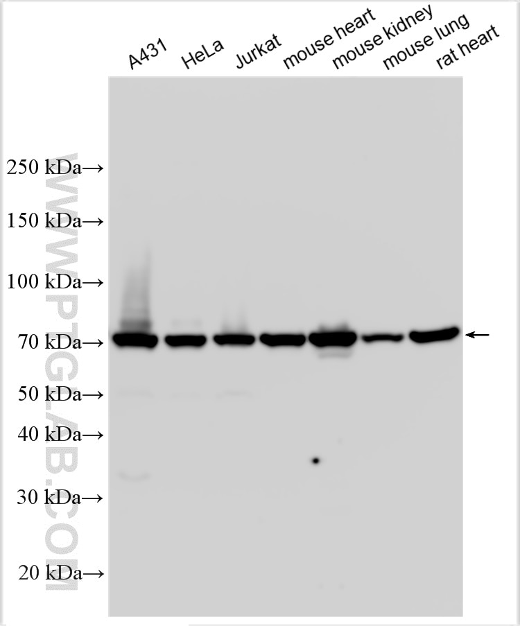 Western Blot (WB) analysis of various lysates using RAB11FIP5 Polyclonal antibody (14594-1-AP)