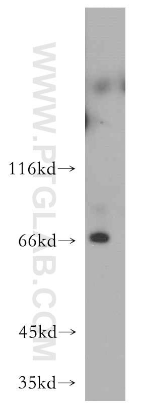 Western Blot (WB) analysis of HEK-293 cells using RAB11FIP5 Polyclonal antibody (14594-1-AP)