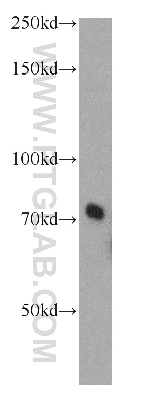 Western Blot (WB) analysis of human heart tissue using RAB11FIP5 Polyclonal antibody (14594-1-AP)