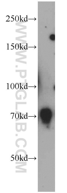 Western Blot (WB) analysis of mouse lung tissue using RAB11FIP5 Polyclonal antibody (14594-1-AP)