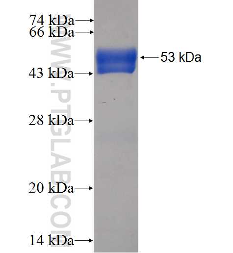 RAB11FIP5 fusion protein Ag6128 SDS-PAGE