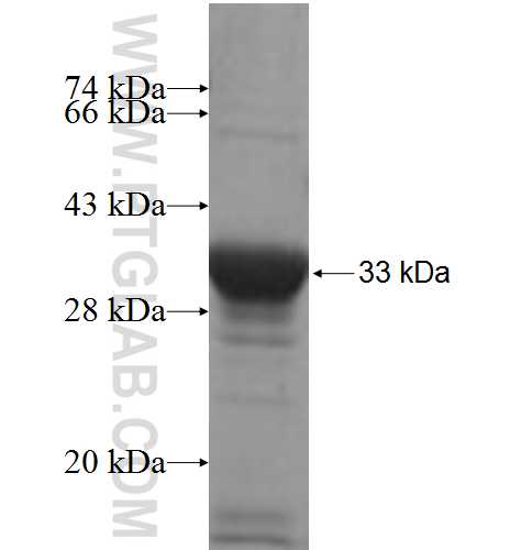 RAB11FIP5 fusion protein Ag6133 SDS-PAGE
