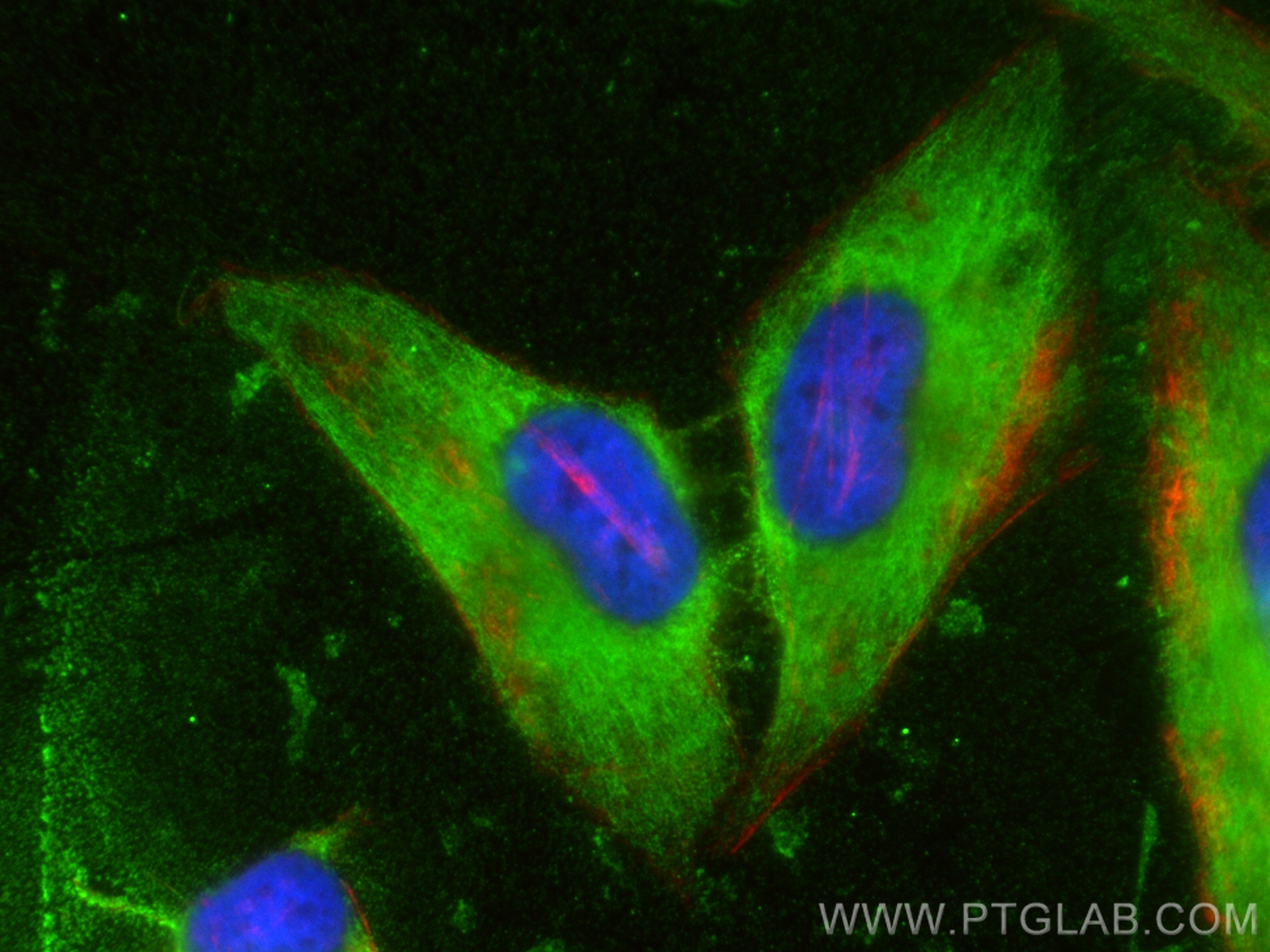 Immunofluorescence (IF) / fluorescent staining of HeLa cells using RAB12 Polyclonal antibody (18843-1-AP)