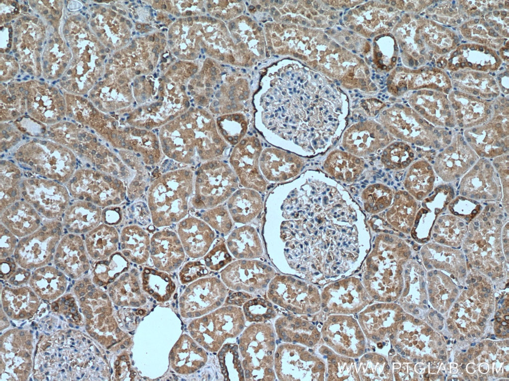 Immunohistochemistry (IHC) staining of human kidney tissue using RAB12 Polyclonal antibody (18843-1-AP)