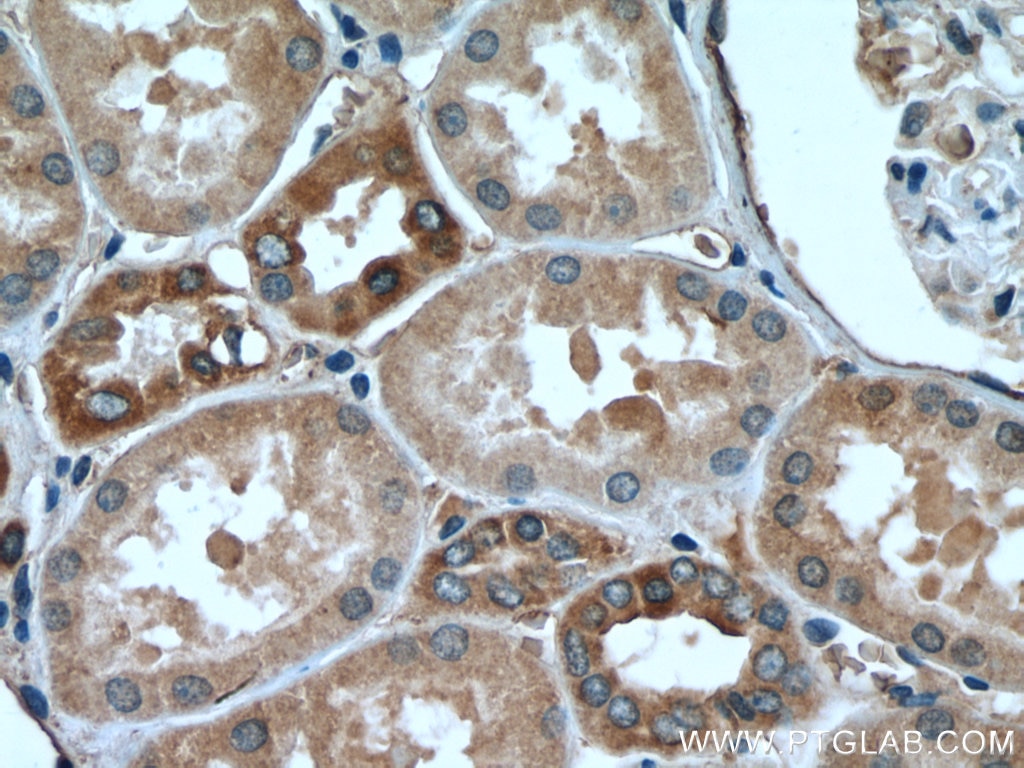 Immunohistochemistry (IHC) staining of human kidney tissue using RAB12 Polyclonal antibody (18843-1-AP)