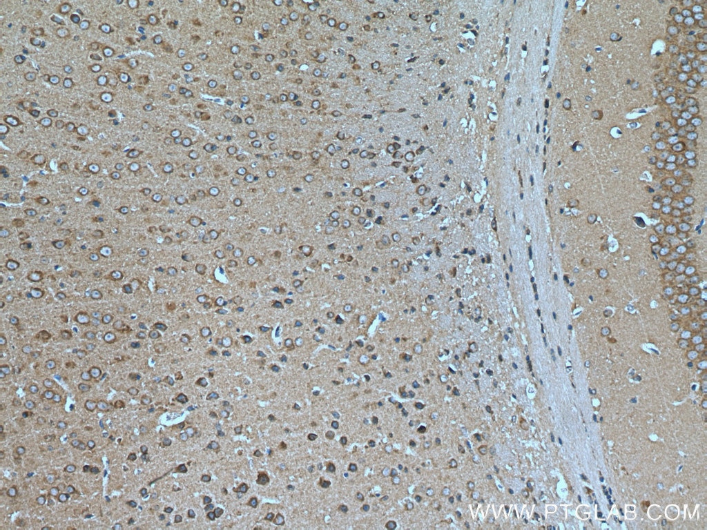 Immunohistochemistry (IHC) staining of mouse brain tissue using RAB12 Polyclonal antibody (18843-1-AP)