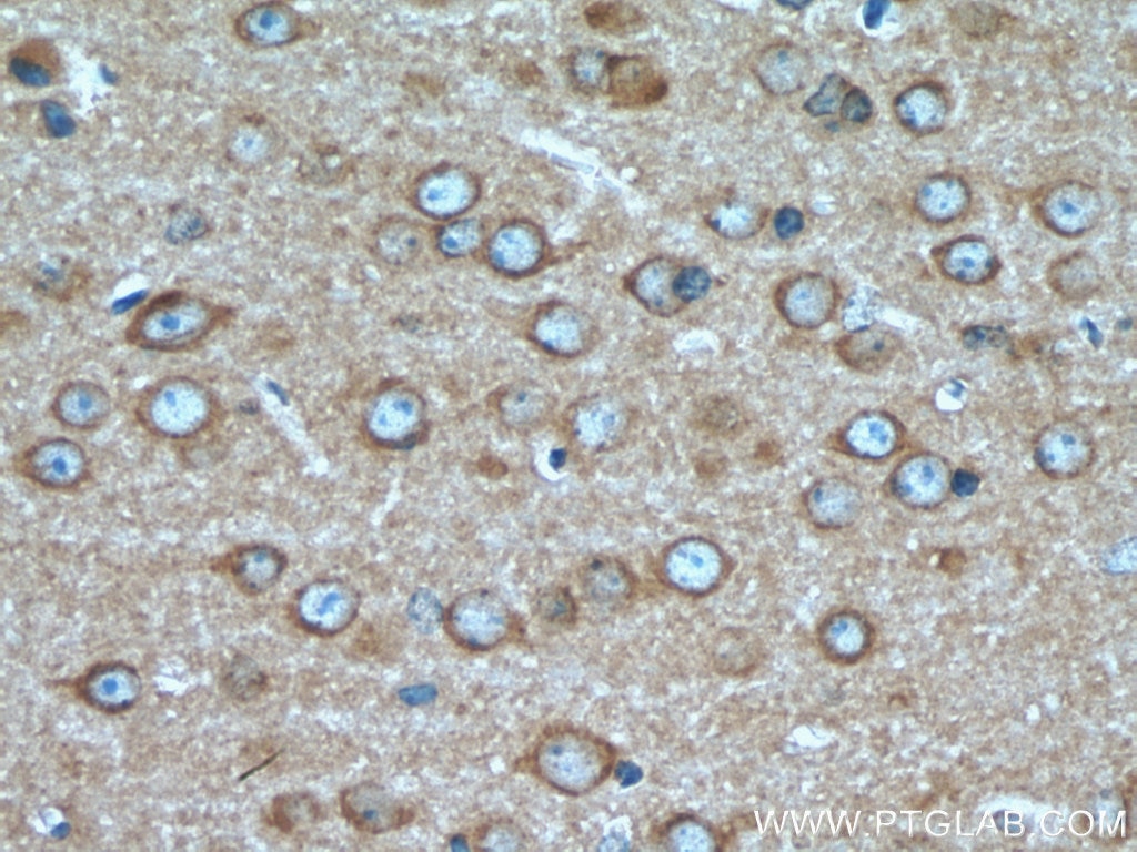 Immunohistochemistry (IHC) staining of mouse brain tissue using RAB12 Polyclonal antibody (18843-1-AP)