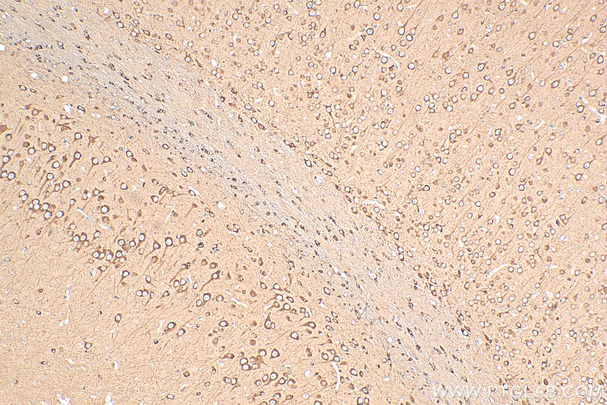 Immunohistochemistry (IHC) staining of rat brain tissue using RAB12 Polyclonal antibody (18843-1-AP)