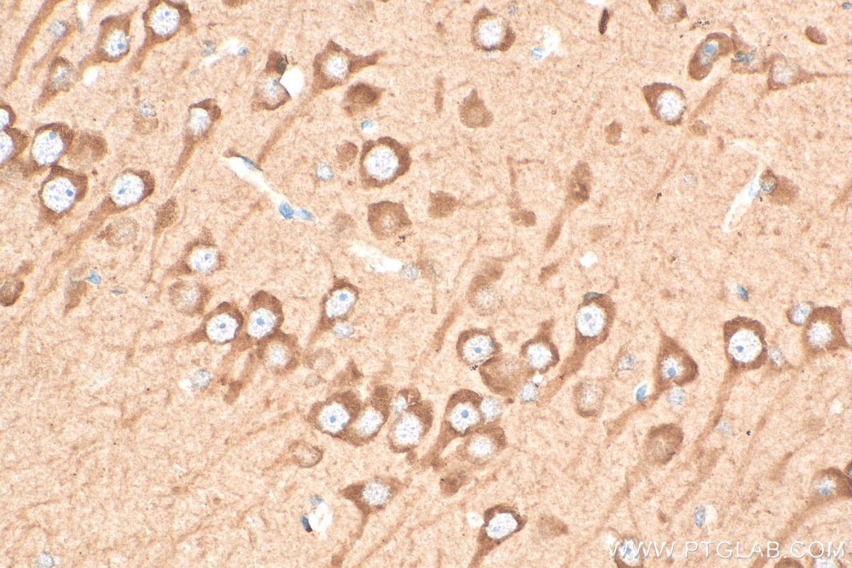 Immunohistochemistry (IHC) staining of rat brain tissue using RAB12 Polyclonal antibody (18843-1-AP)
