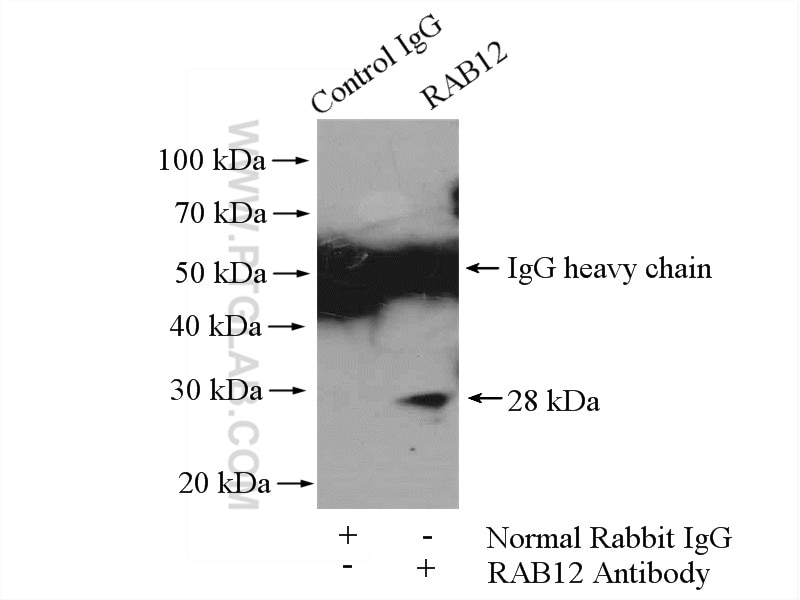 Immunoprecipitation (IP) experiment of HeLa cells using RAB12 Polyclonal antibody (18843-1-AP)