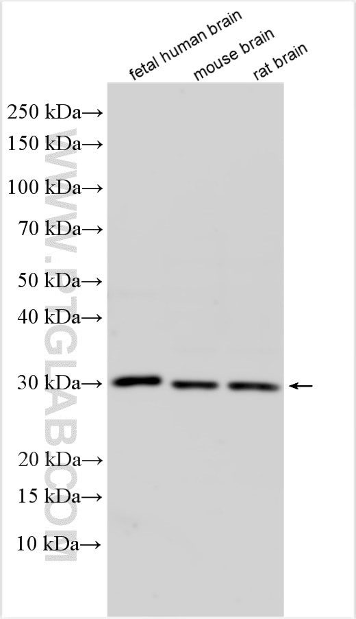 Western Blot (WB) analysis of various lysates using RAB12 Polyclonal antibody (18843-1-AP)