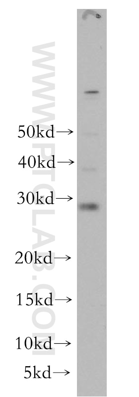Western Blot (WB) analysis of HeLa cells using RAB12 Polyclonal antibody (18843-1-AP)
