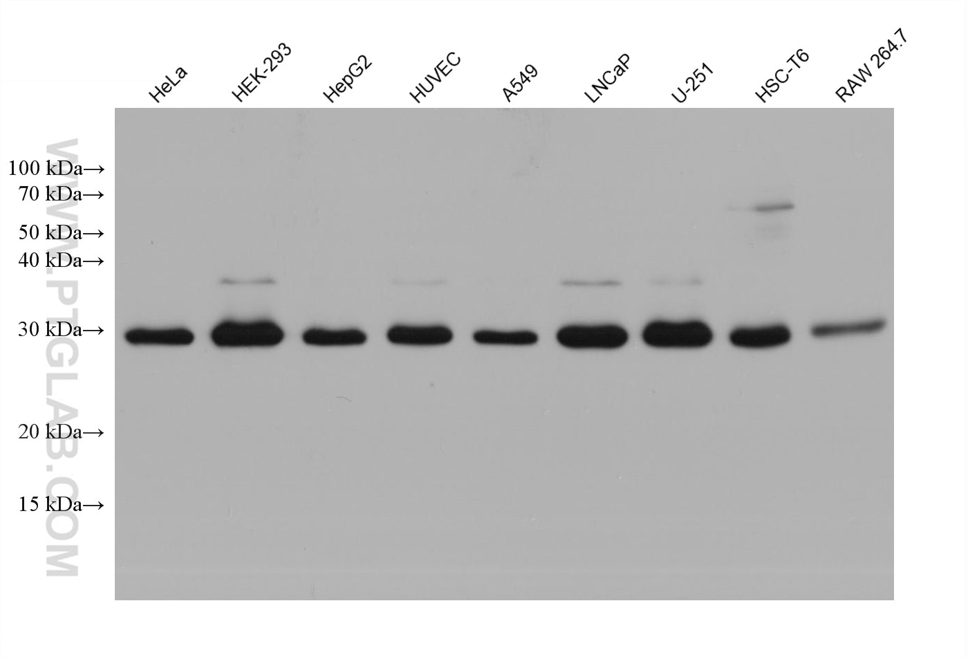 Western Blot (WB) analysis of various lysates using RAB12 Monoclonal antibody (68079-1-Ig)