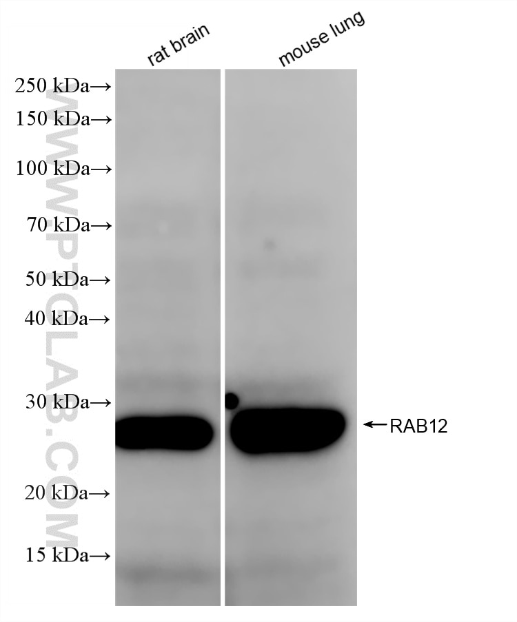 Western Blot (WB) analysis of various lysates using RAB12 Recombinant antibody (86560-1-RR)