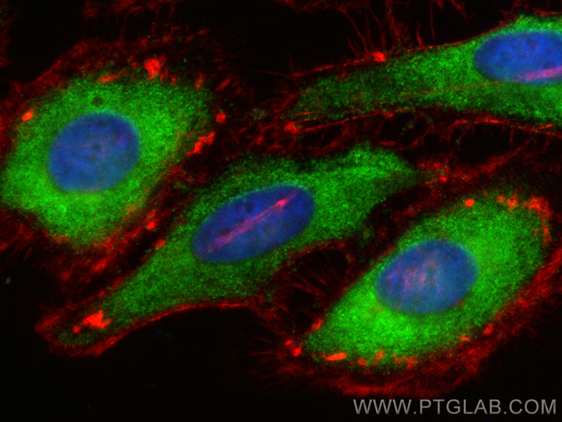 Immunofluorescence (IF) / fluorescent staining of HeLa cells using CoraLite® Plus 488-conjugated RAB12 Polyclonal ant (CL488-18843)