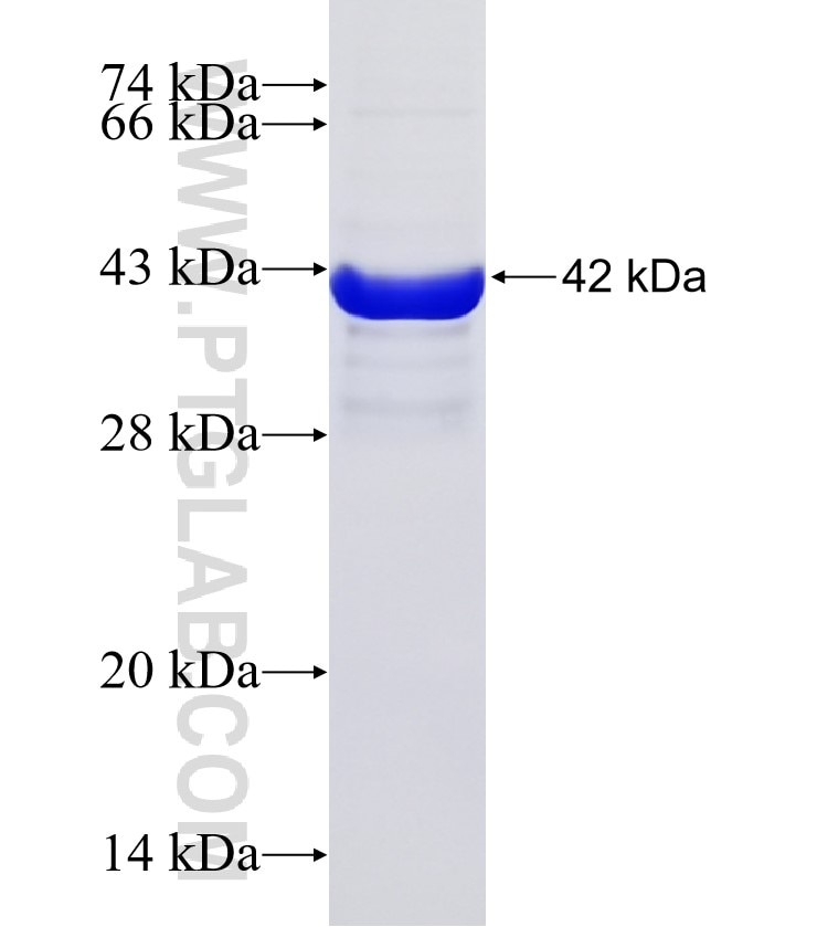 RAB12 fusion protein Ag31627 SDS-PAGE