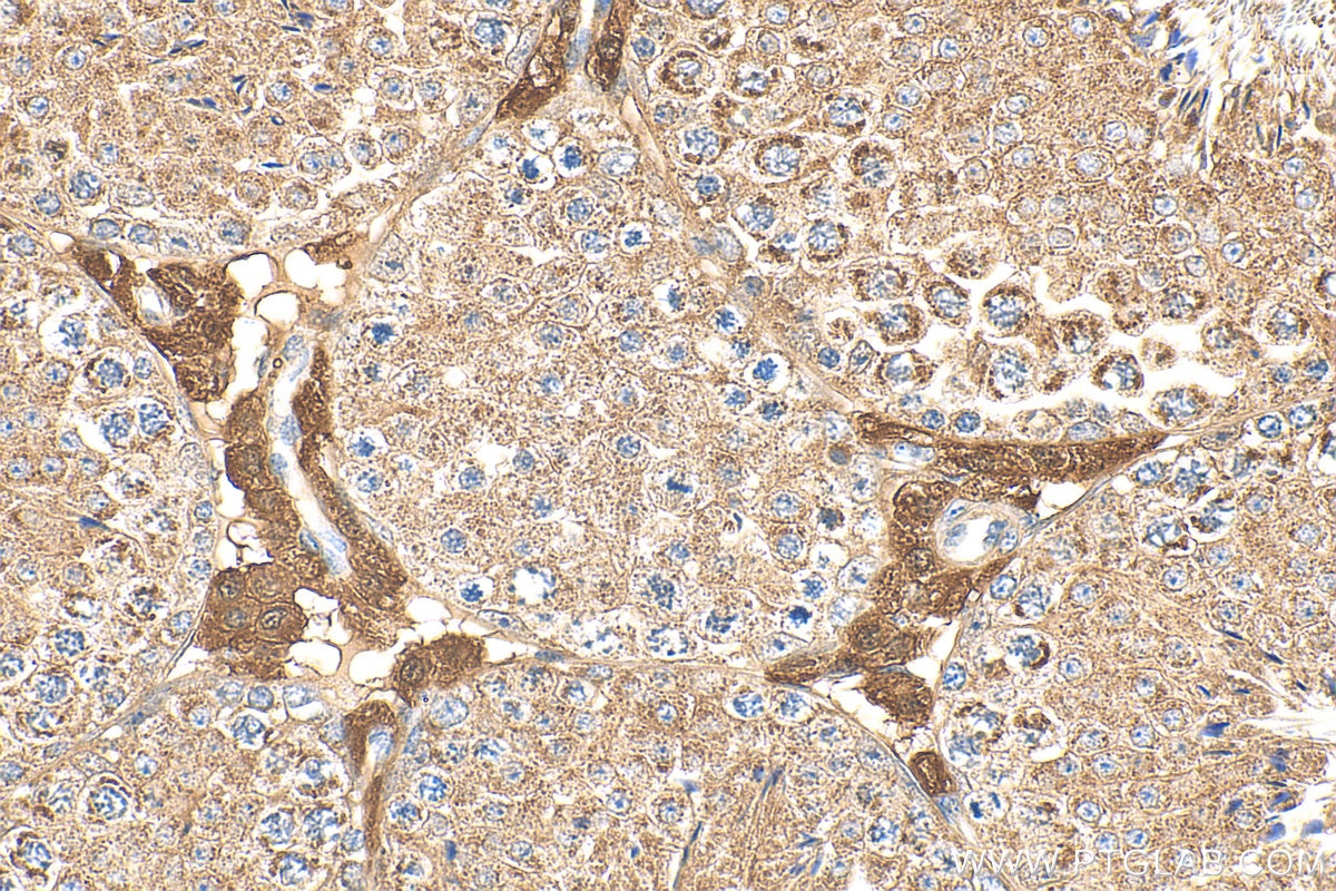 Immunohistochemistry (IHC) staining of mouse testis tissue using RAB13 Polyclonal antibody (11718-1-AP)