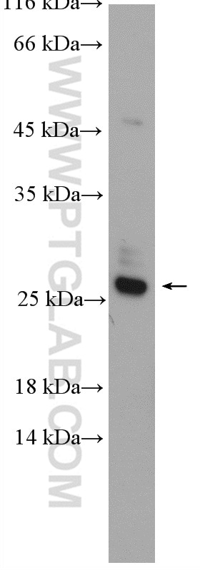 Western Blot (WB) analysis of HepG2 cells using RAB14 Polyclonal antibody (15662-1-AP)