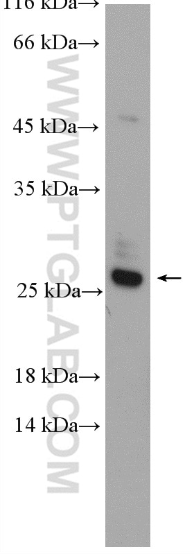 WB analysis of HepG2 using 15662-1-AP