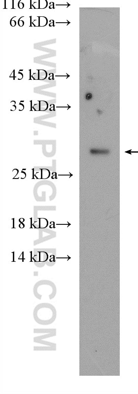Western Blot (WB) analysis of Raji cells using RAB14 Polyclonal antibody (15662-1-AP)