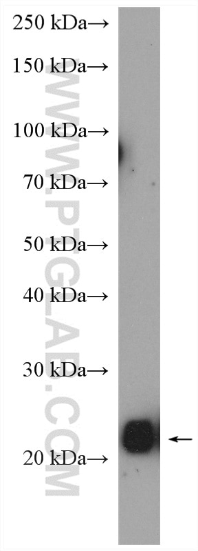 Western Blot (WB) analysis of mouse brain tissue using RAB14 Polyclonal antibody (15662-1-AP)