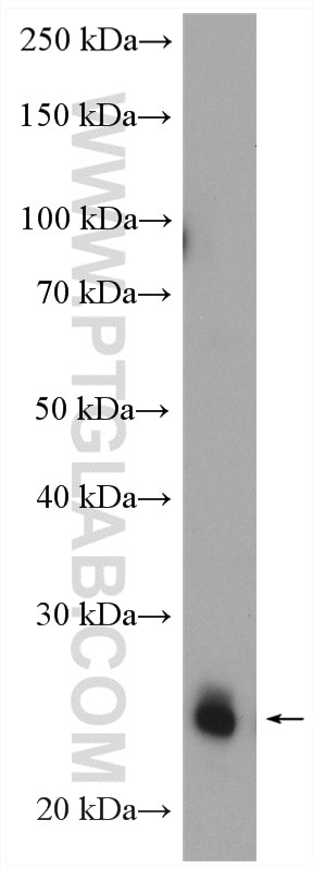Western Blot (WB) analysis of mouse kidney tissue using RAB14 Polyclonal antibody (15662-1-AP)