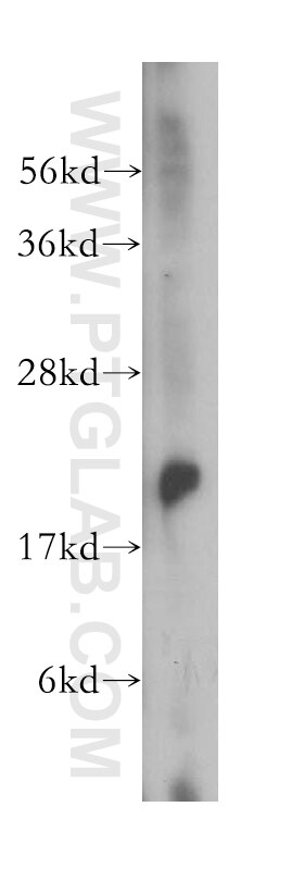 Western Blot (WB) analysis of human brain tissue using RAB14 Polyclonal antibody (15662-1-AP)