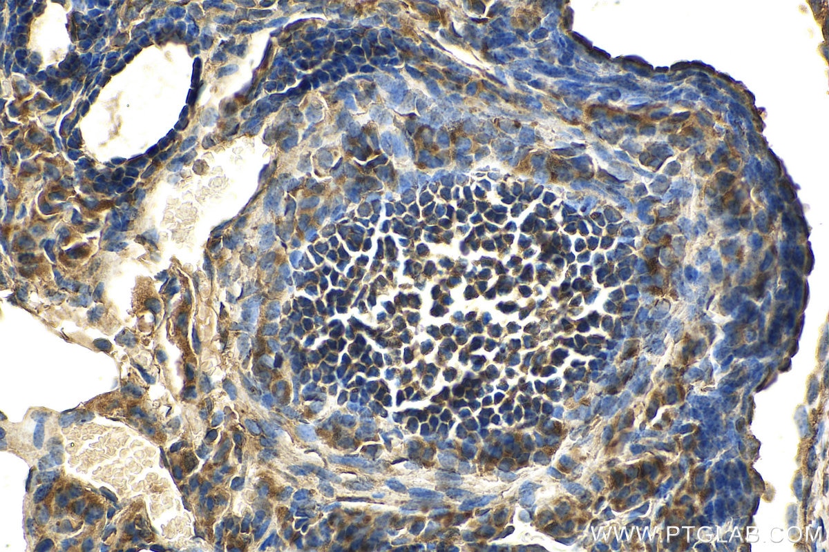 Immunohistochemistry (IHC) staining of mouse ovary tissue using RAB14 Monoclonal antibody (67953-1-Ig)