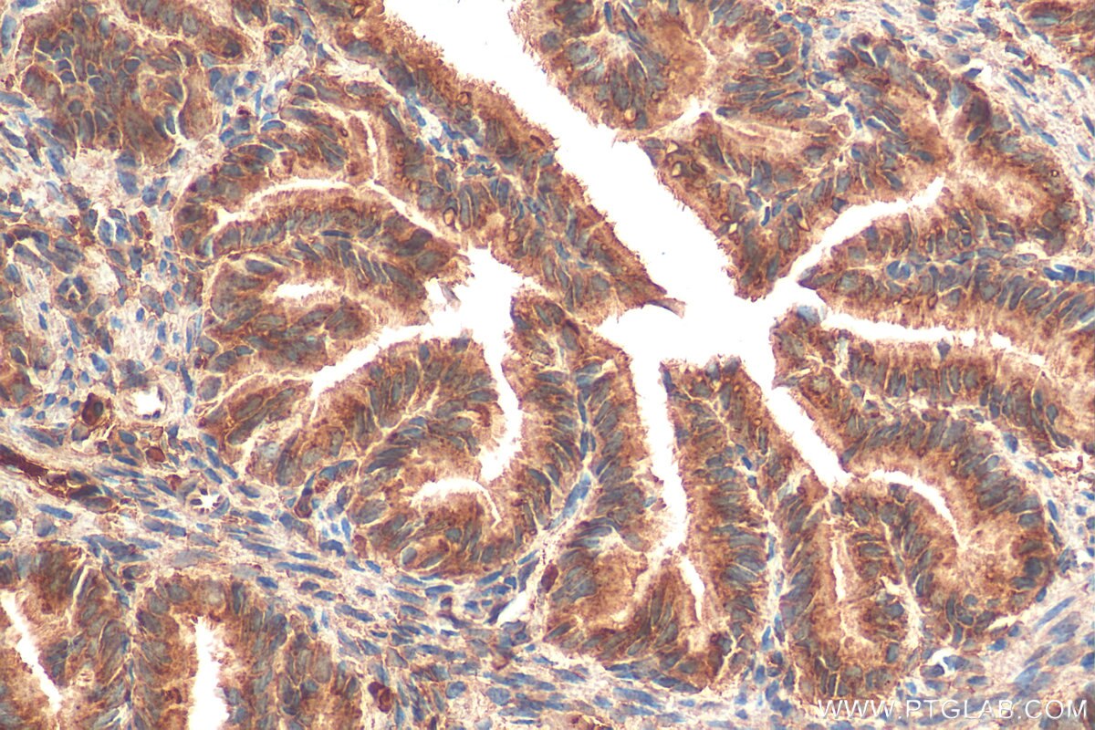 Immunohistochemistry (IHC) staining of mouse ovary tissue using RAB14 Monoclonal antibody (67953-1-Ig)