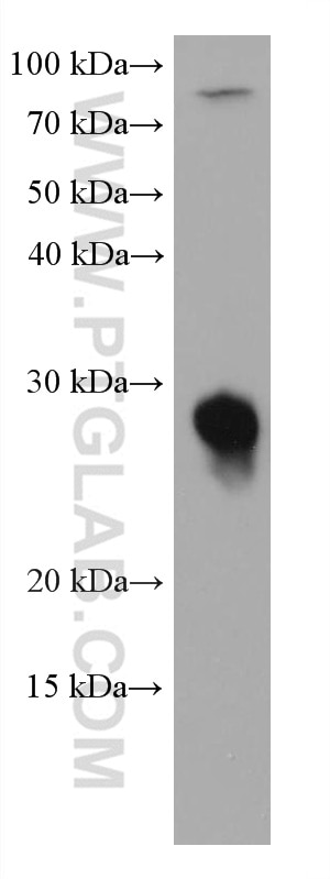 WB analysis of HCT 116 using 67953-1-Ig
