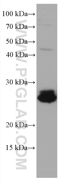 Western Blot (WB) analysis of K-562 cells using RAB14 Monoclonal antibody (67953-1-Ig)