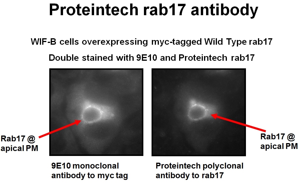 Immunofluorescence (IF) / fluorescent staining of WIF-B cells using RAB17 Polyclonal antibody (17501-1-AP)