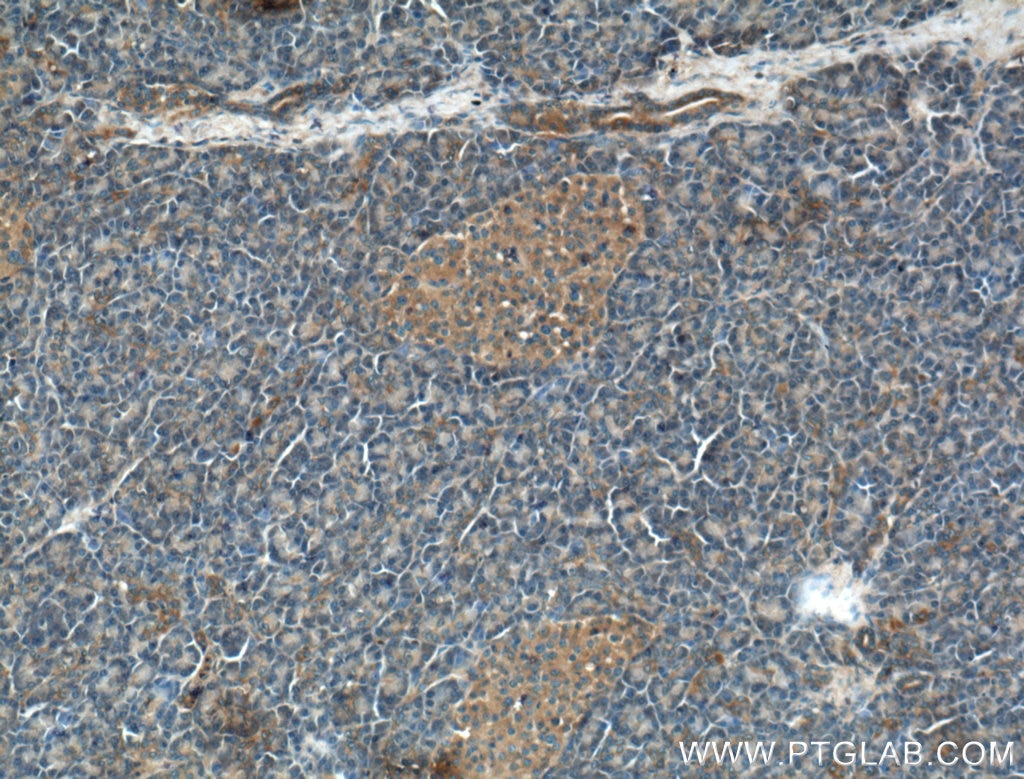 IHC staining of human pancreas using 17501-1-AP