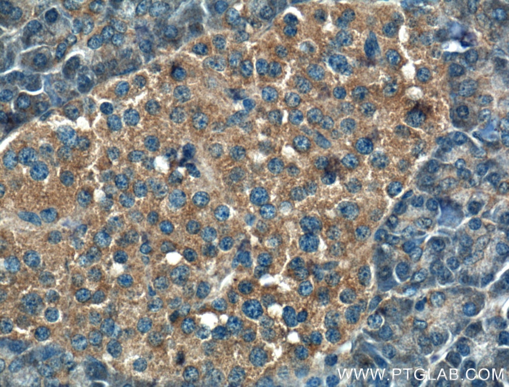 Immunohistochemistry (IHC) staining of human pancreas tissue using RAB17 Polyclonal antibody (17501-1-AP)