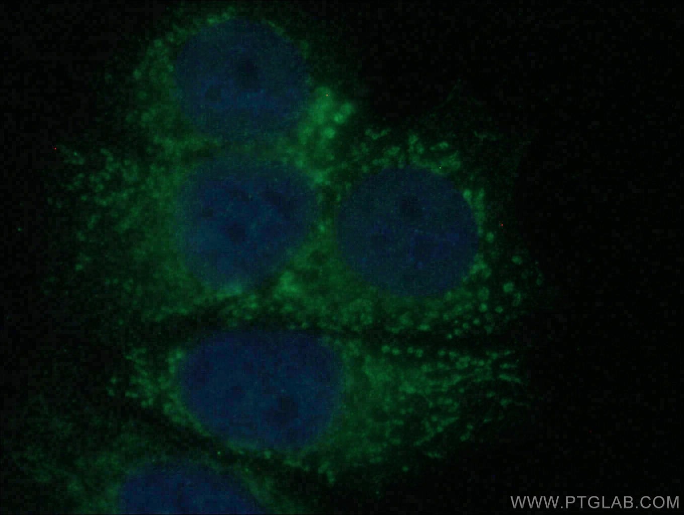 Immunofluorescence (IF) / fluorescent staining of MCF-7 cells using RAB17 Polyclonal antibody (28274-1-AP)