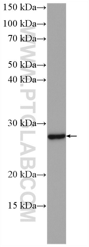 Western Blot (WB) analysis of fetal human brain tissue using RAB17 Polyclonal antibody (28274-1-AP)